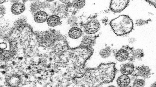 正式名称で呼ばれない…