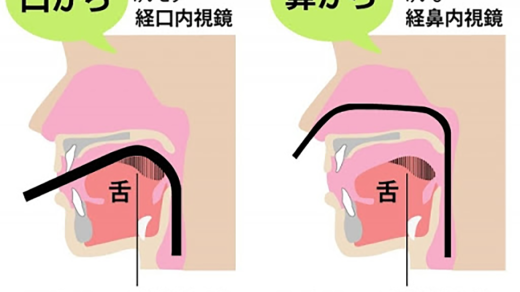鼻カメラが主流になるといいのに…